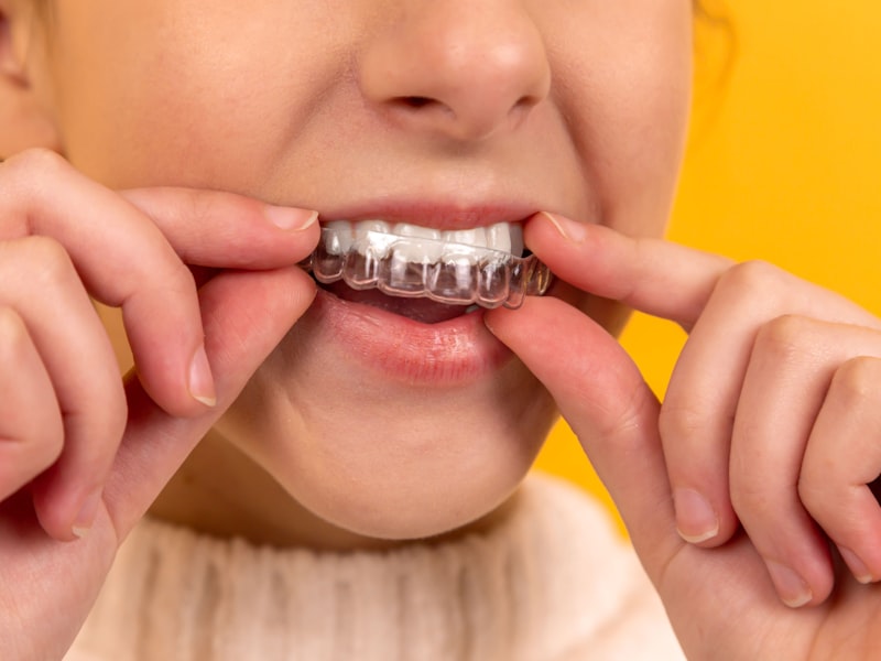 Dental Checkups
